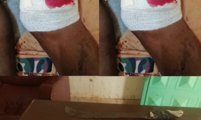 إطلاق نار في عملية قبض على معتاد إجرام بأمدرمان