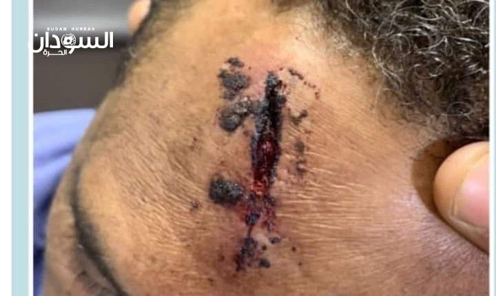 اجتماع طارئ في الهلال بسبب حادثة”الطاهر يونس” – السودان الحرة